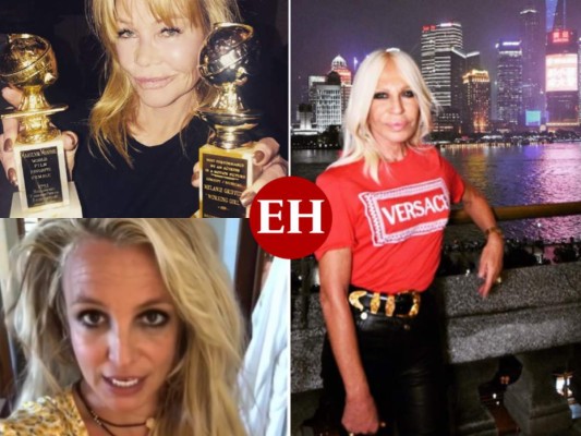 Antes y después de famosos que desfiguraron sus rostros con cirugías