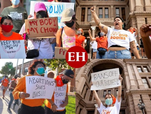 Como 'radical' han calificado muchos la nueva ley de aborto aplicada en el estado de Texas donde no permite a las mujeres realizar el procedimiento una vez que se escuchen los latidos del corazón. Más sobre la polémica ley aquí. Fotos: AP