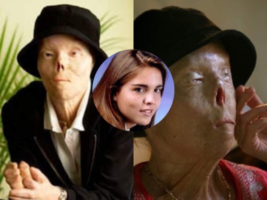 Muere Jacqui Saburido, la venezolana que se convirtió en el rostro de tragedias por conductores ebrios&nbsp;&nbsp;