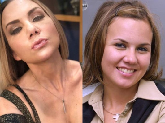 Michelle Vieth, actriz de Clase 406, revela qué cirugías se ha realizado