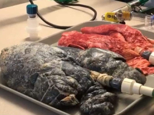 Viral: Enfermera publica impactante vídeo del daño a los pulmones por fumar