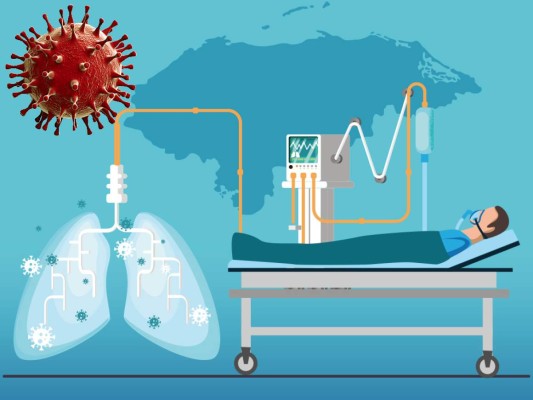 Honduras: La mitad de los hospitales no tienen respiradores en plena emergencia por Covid-19