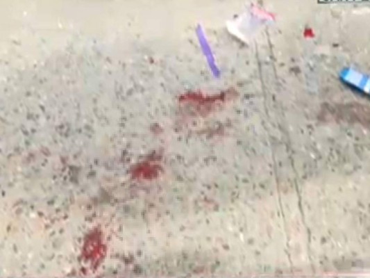 Tirotean a guardia de seguridad y vendedor en barrio El Centro de San Pedro Sula