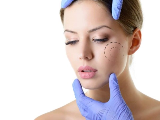 Bichectomía, la cirugía cosmética en tendencia para perfilar el rostro