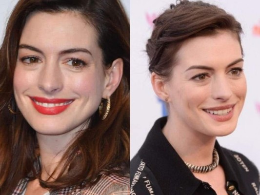 Antes y después: Famosas que se raparon el pelo y lucieron hermosas