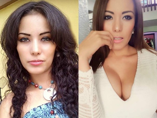 Famosas hondureñas que admitieron públicamente someterse a una cirugía plástica