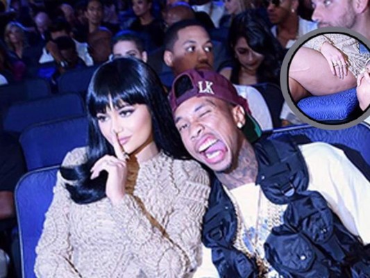 Foto de Kylie Jenner con celulitis se vuelve viral en internet