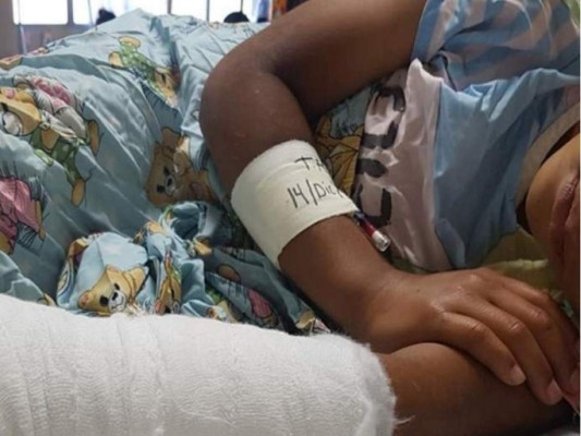 Una niña de 13 años, quinta víctima de la pólvora en Honduras