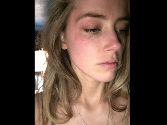 Amber Heard y Johnny Deep: así fue la polémica relación que espera un veredicto legal