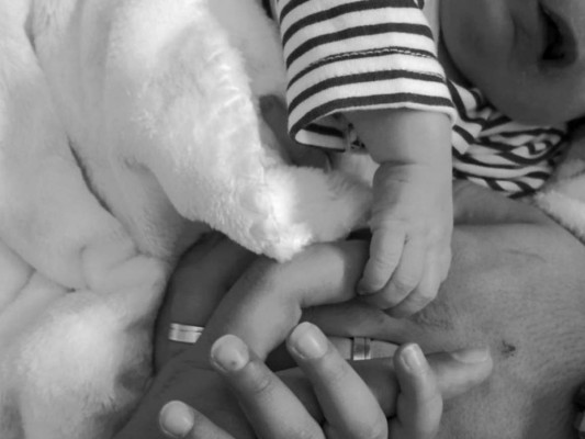 Bebé nace sin una parte de su cráneo, nariz y ojos en Portugal