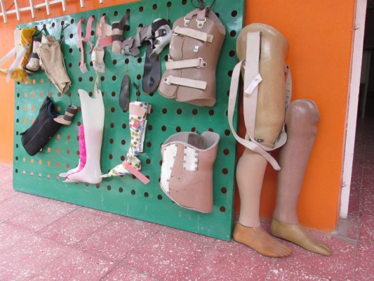 Hondureño construye esperanzas tallando prótesis