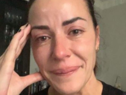 Despiden a la modelo Inés Sainz tras confesar que sufre cáncer de mama