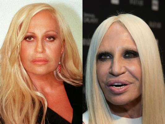 FOTOS: 10 famosas que cambiaron sus rostros