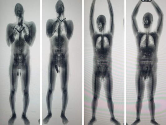 Madres que visitaron a sus hijos introdujeron droga en El Pozo I, en Ilama, Santa Bárbara