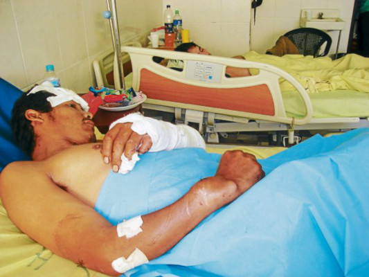 Violencia y accidentes suben cifras de personas con limitaciones físicas