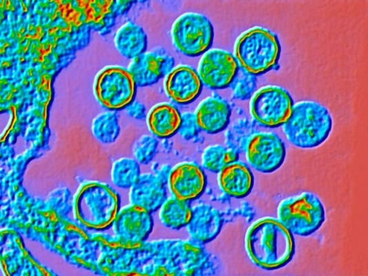 10 datos sobre el hantavirus, enfermedad transmitida por roedores