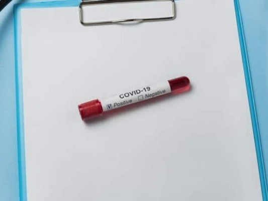 Coronavirus no fue creado por el hombre ni modificado genéticamente, dice inteligencia de EEUU&nbsp;&nbsp;