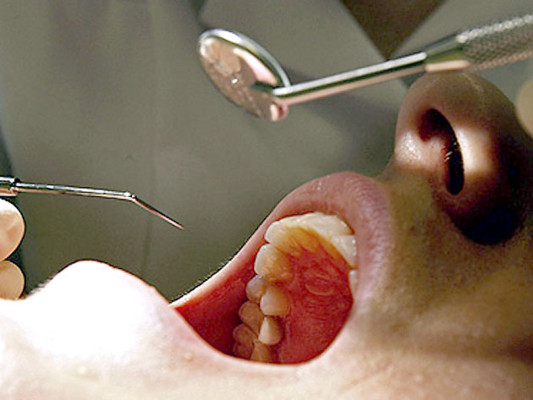Ex lo deja sin dientes