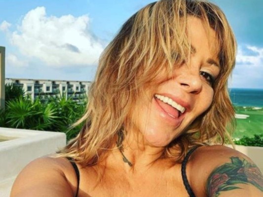 Estas son las famosas que se arrepienten de sus cirugías plásticas