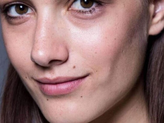 ¿Cómo eliminar las ojeras?