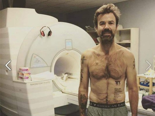 Cantante de Jarabe de Palo anuncia que vuelve a sufrir cáncer