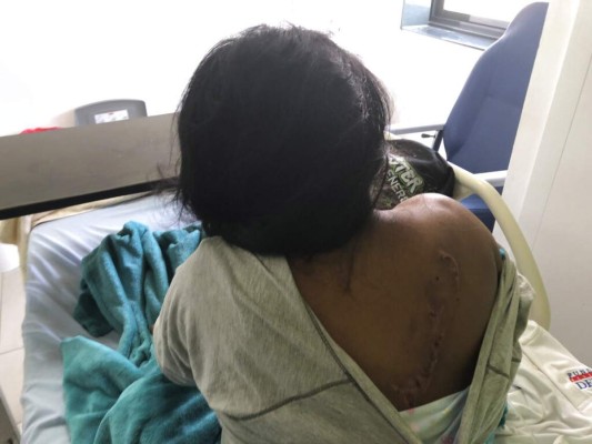 Indígena panameña acepta orar, pero secta mata su hija&nbsp;