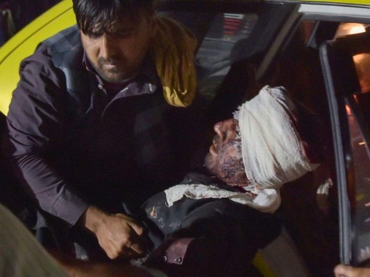 Decenas de muertos y cientos de heridos tras el ataque en las afueras del aeropuerto de Kabul, Afganistán
