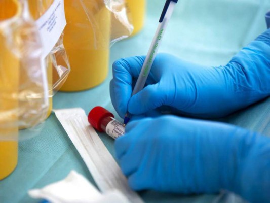 Covid en Honduras: No lograron rescatar ni una de las 250,000 pruebas PCR dañadas