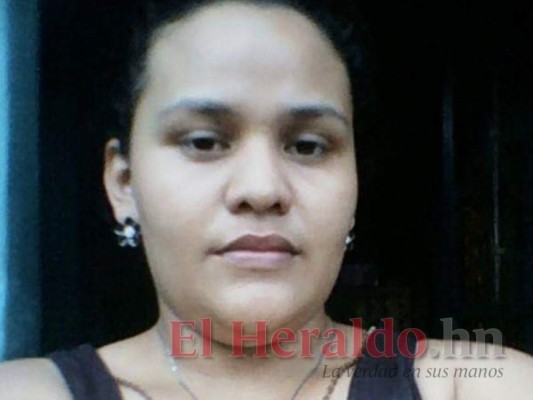 Choloma: Fotos del accidente que dejó una joven muerta y tres heridos