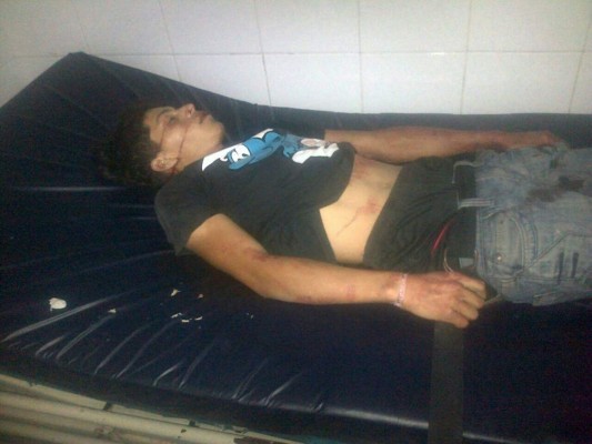 Cuatro muertos deja tiroteo en la capital de Honduras