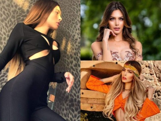 Cheyla Navarro, influencer que lucha por su vida tras ser acribillada