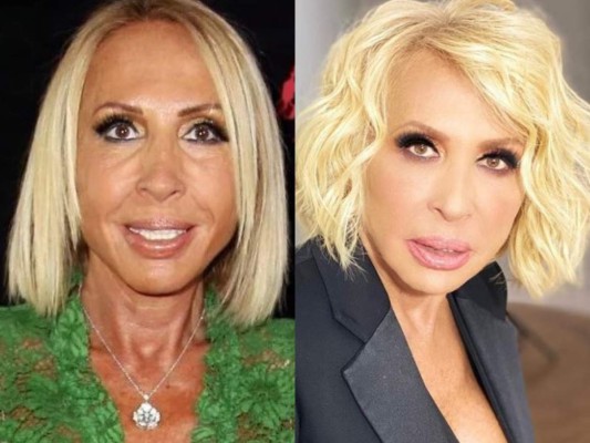 FOTOS: El cambio de Laura Bozzo tras destruir su cara con bótox
