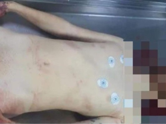 Una bala, una patrulla chocada, drogas y un robo: inconsistencias en la muerte de Octavio Ocaña