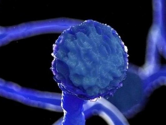 Cómo evitar contraer el letal hongo negro, la 'cara B” de la pandemia (FOTOS)