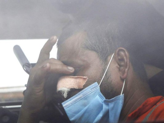 Cómo evitar contraer el letal hongo negro, la 'cara B” de la pandemia (FOTOS)