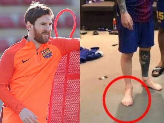 ¿Messi tiene seis dedos en el pie derecho? Imagen del argentino se vuelve viral