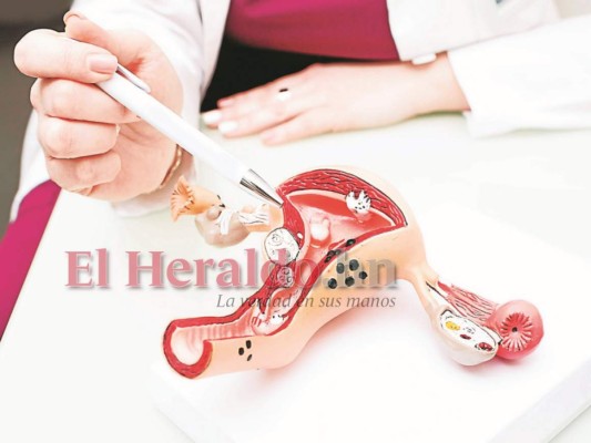 El cáncer está en los hábitos