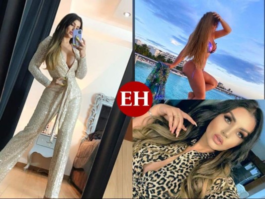 Las cirugías de Mariana González, la Kim Kardashian mexicana (FOTOS)