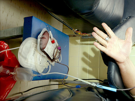 Déficit de sangre en el hospital Escuela