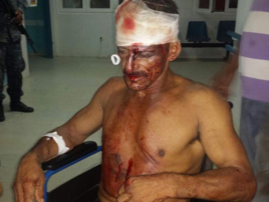 Linchan a supuesto padre violador en centro penal