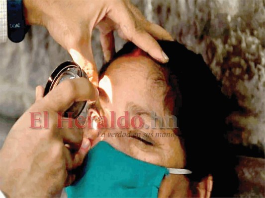 Alta letalidad por hongo negro: fallecen dos de cada tres enfermos