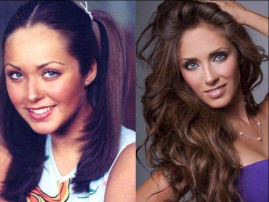 Antes y después: así lucen varias famosas mexicanas después de las cirugías