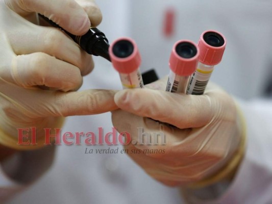 Innecesaria prueba de covid-19 pide Honduras a viajeros para entrar al país