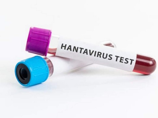 10 datos sobre el hantavirus, enfermedad transmitida por roedores