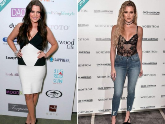 Khloé Kardashian: 'Tuve una mala relación con la comida toda mi vida'