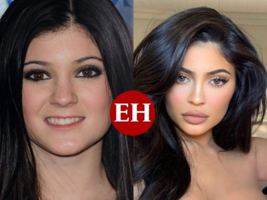¿No se sentía 'digna de besar'? La razón por la que Kylie Jenner se aumentó los labios