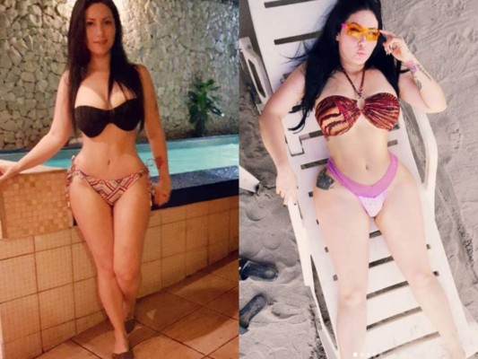 FOTOS: Así lucen estas conocidas hondureñas tras someterse a cirugías