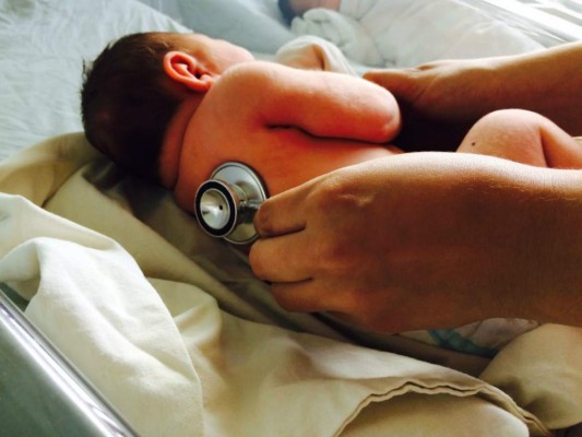 Honduras: Diagnostican otro caso de microcefalia en Hospital Escuela