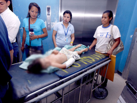 Niño cercena mano de su hermano de tres años