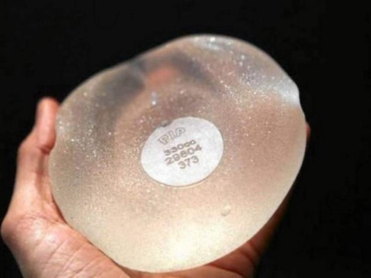 Ocho cosas que debe saber sobre los implantes de senos